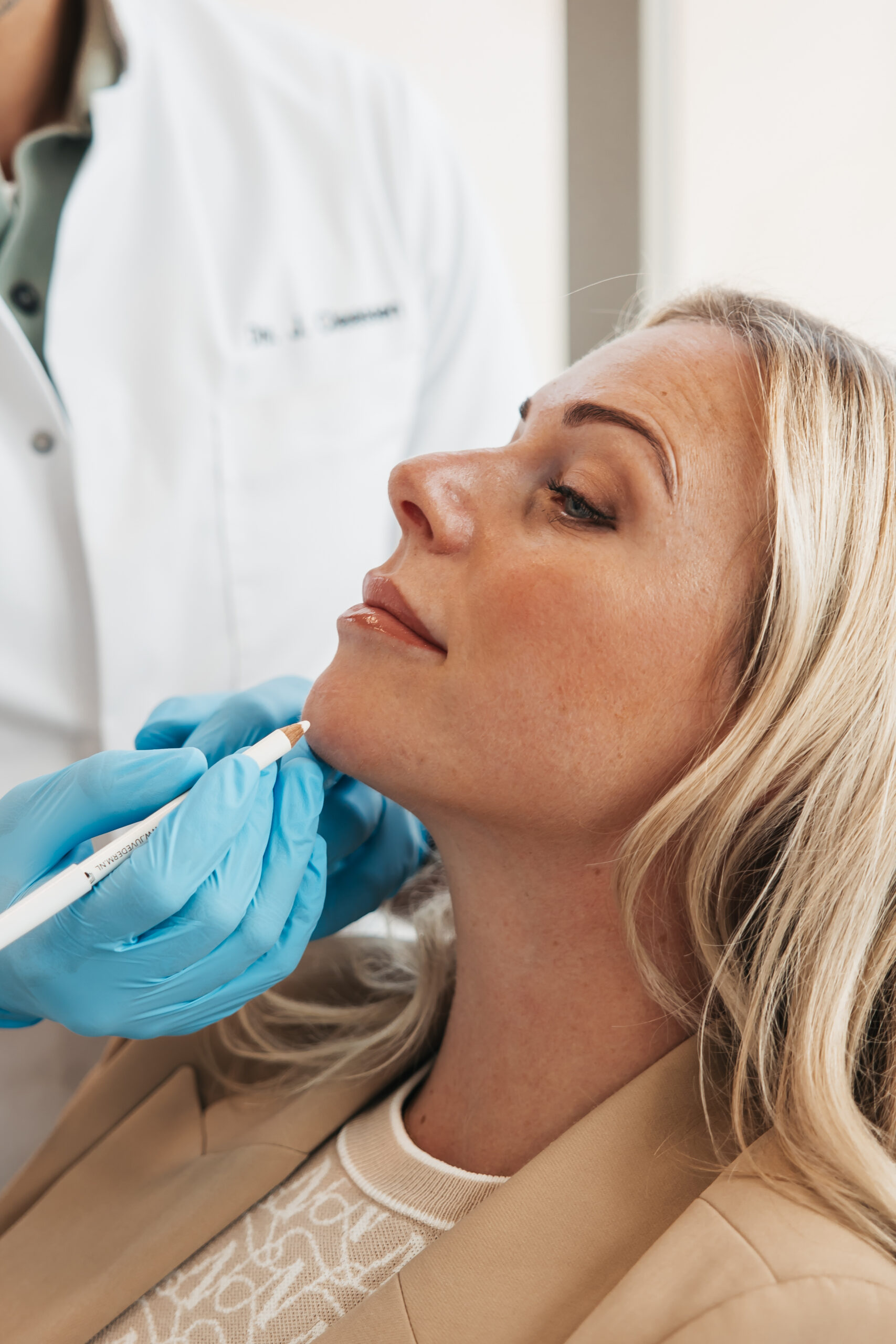 Kin fillers behandeling