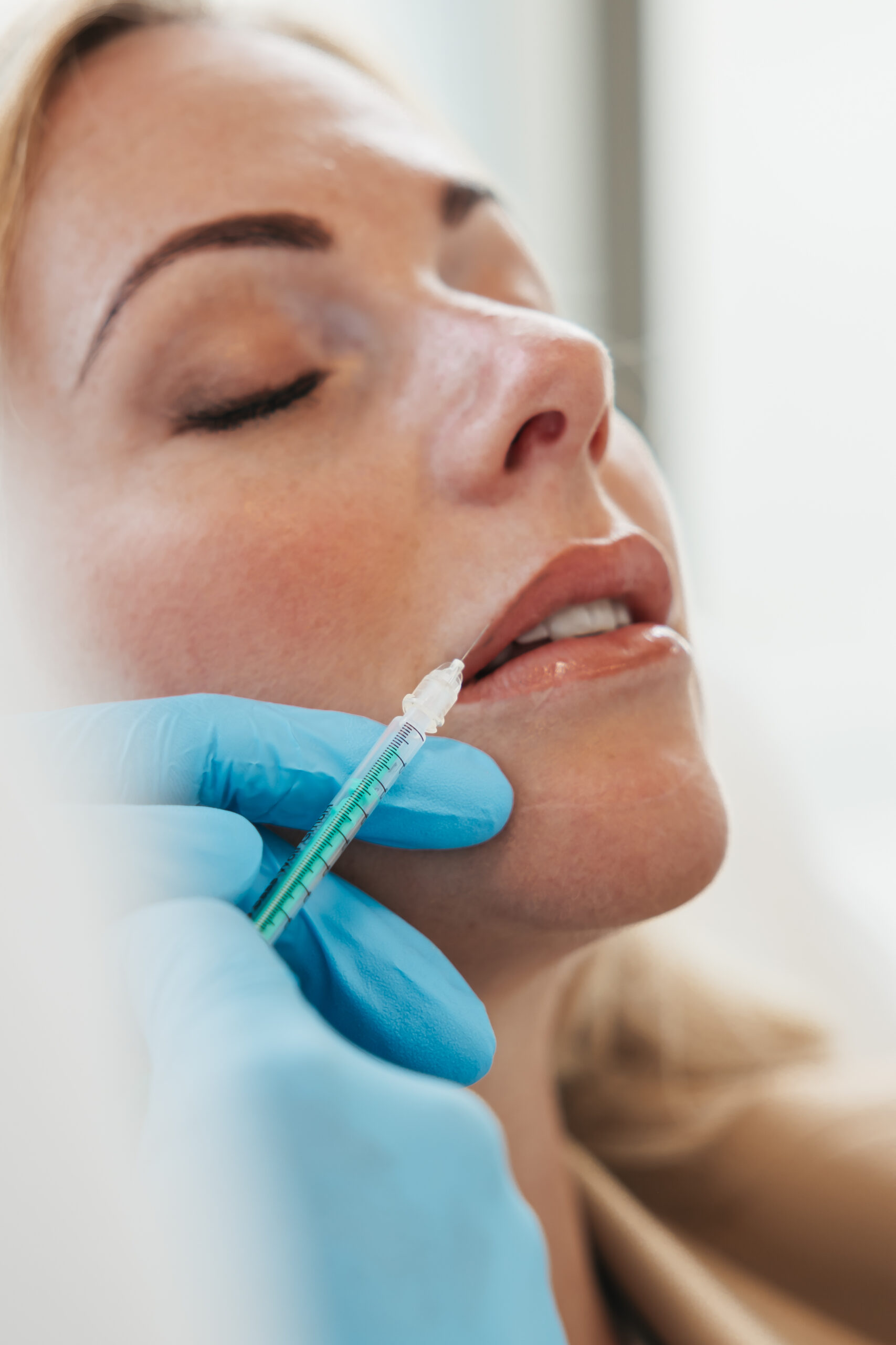 Hoelang blijft Botox zitten?