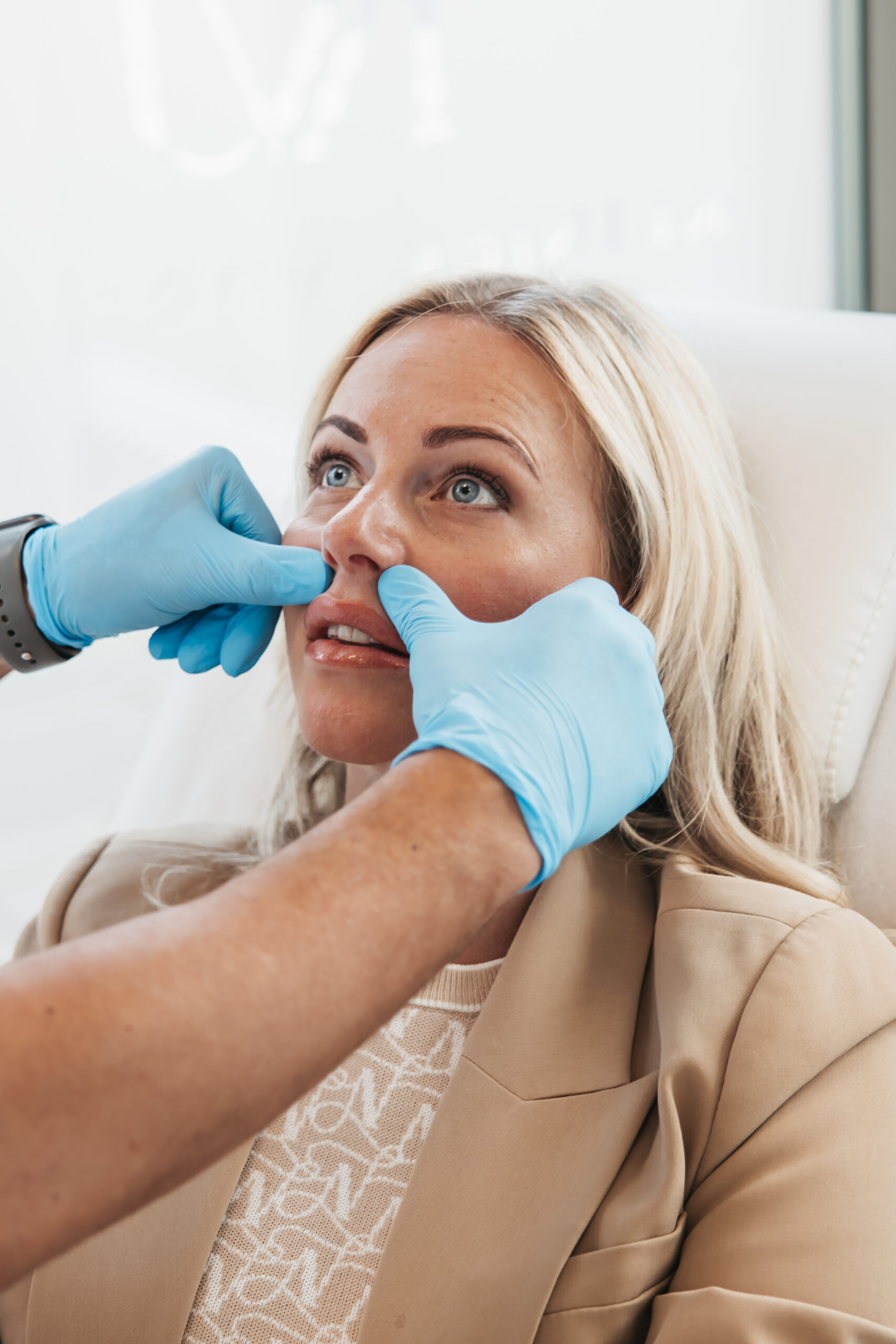 Neuslippenplooi verminderen