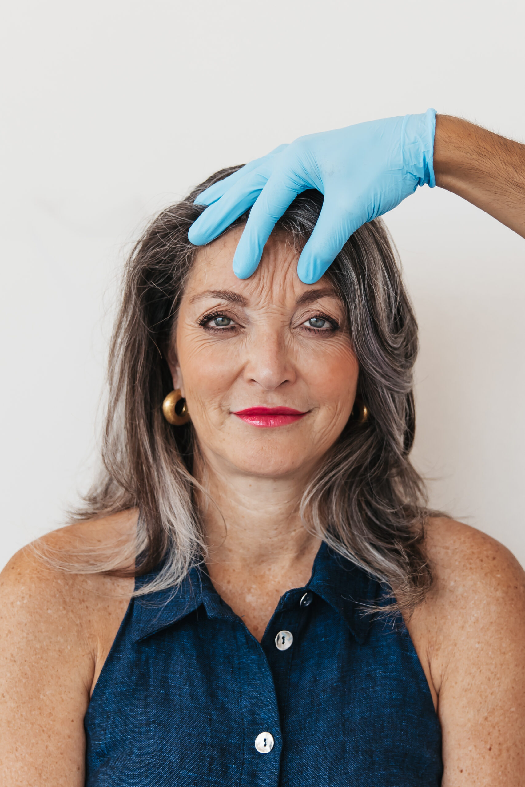 Fijne lijntjes verwijderen zonder botox