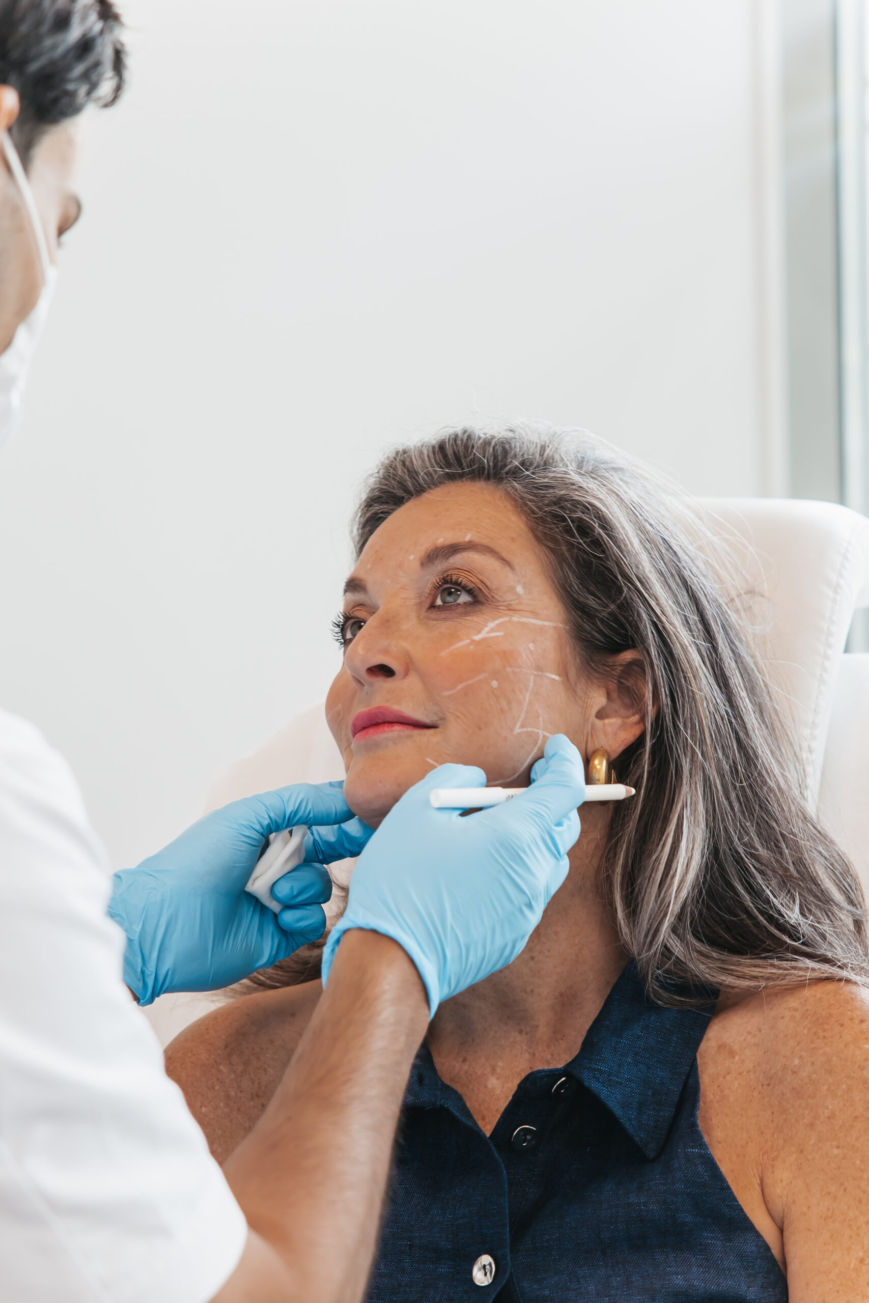 Waar fillers laten zetten?