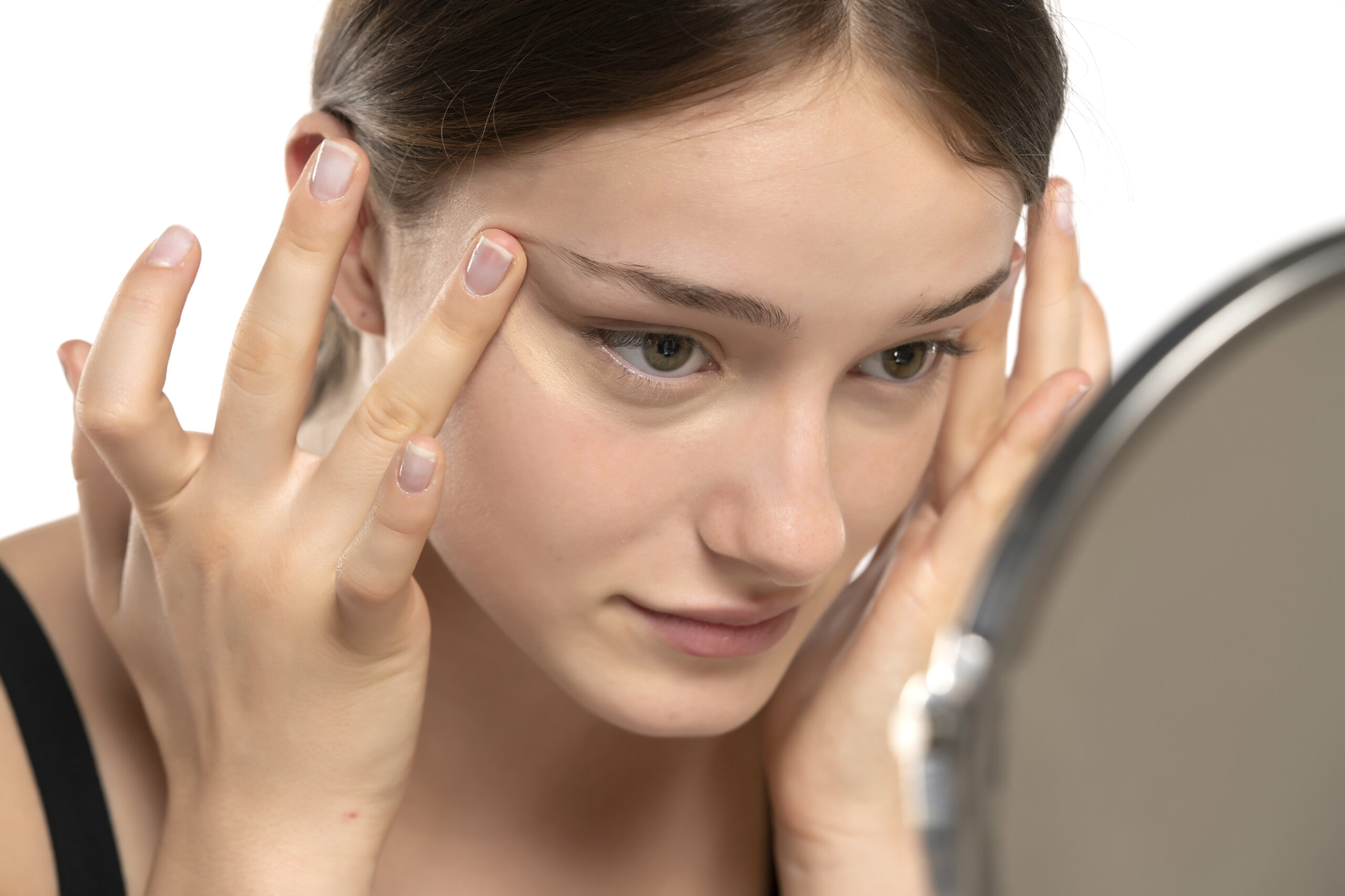 Donkere kringen onder ogen