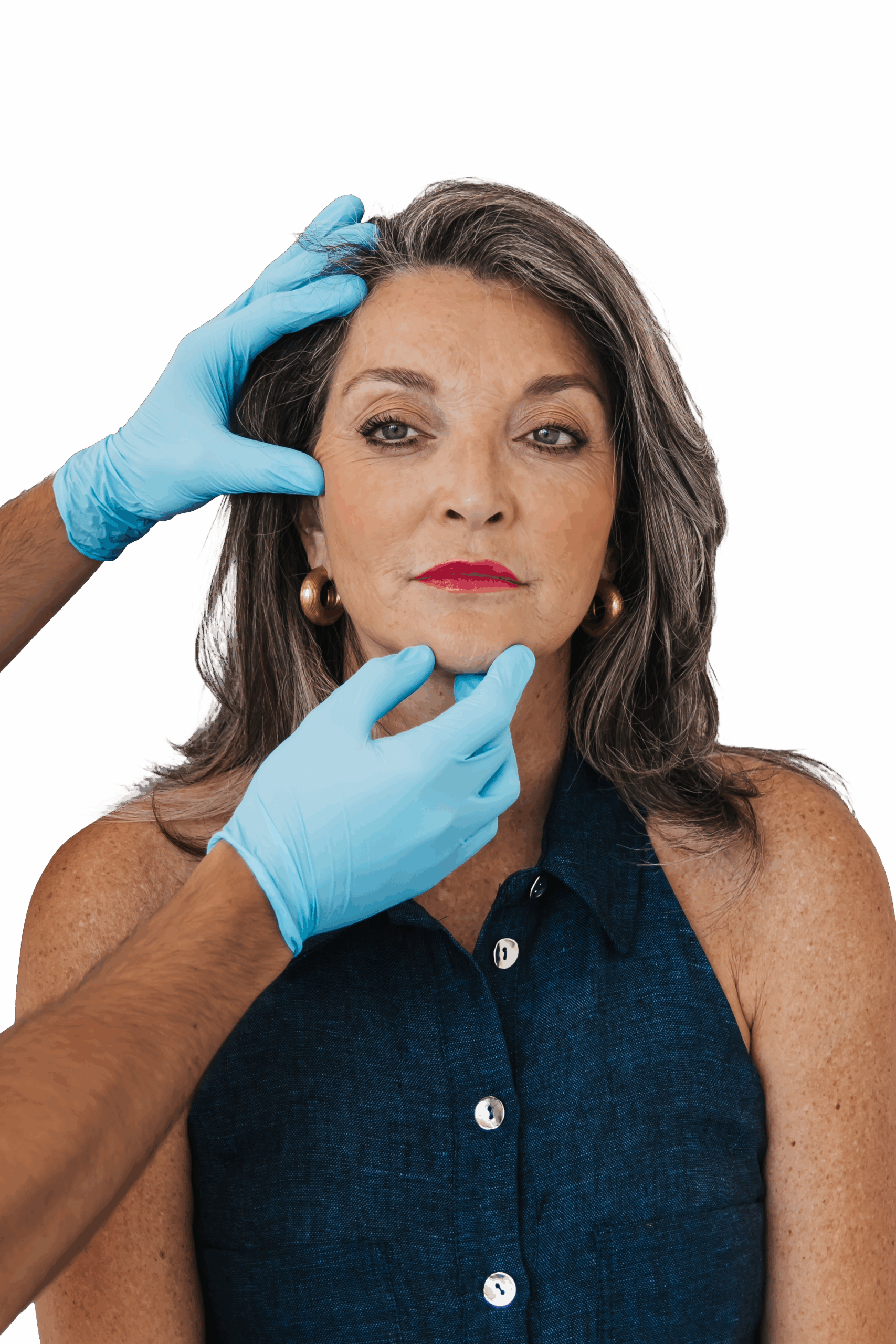 Botox Arnhem