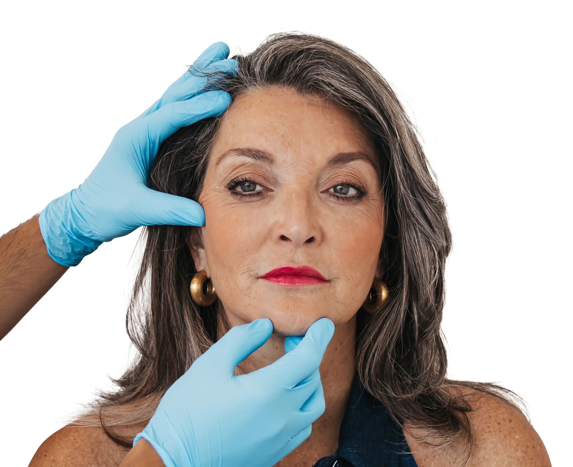 Botox Wijchen